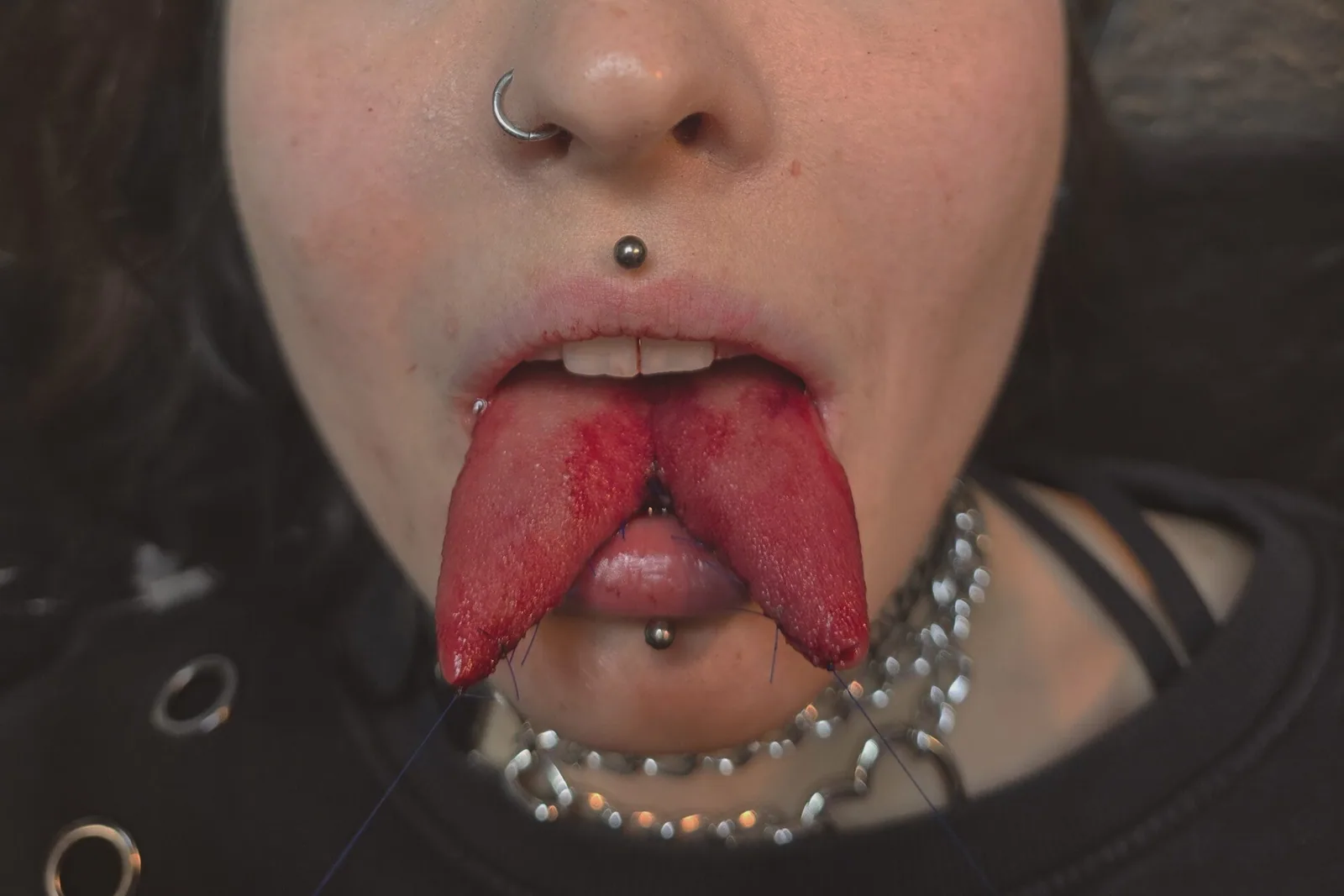 Zungenspaltung / Tonguesplitting – Beispiel 5