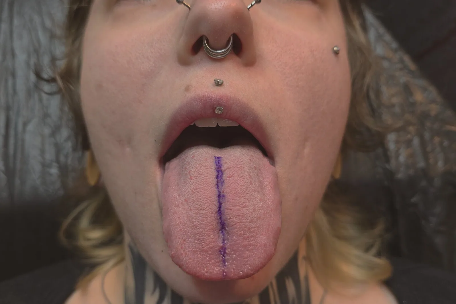 Zungenspaltung / Tonguesplitting – Beispiel 3
