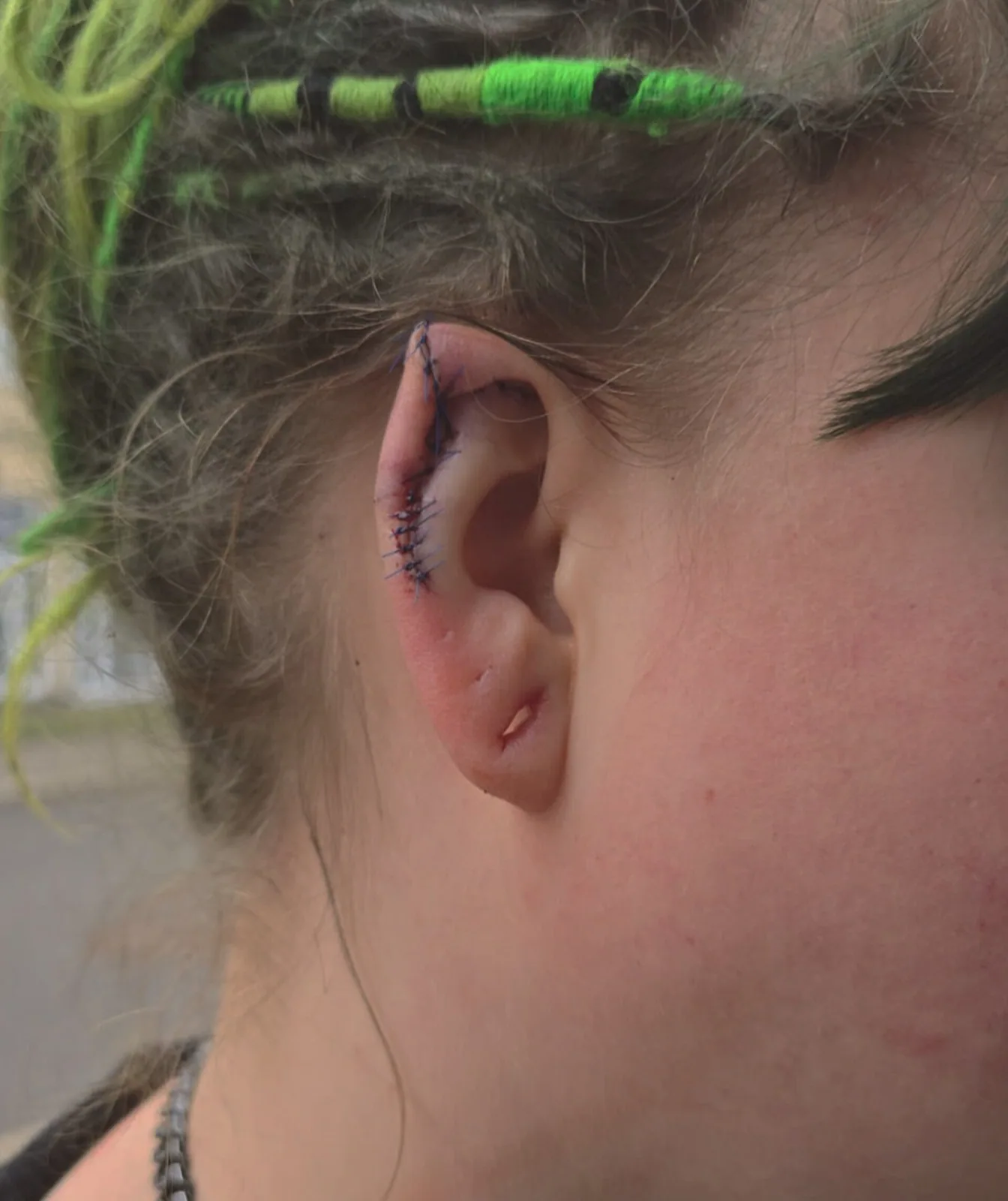 Earpointing – Elfenohren – Beispiel 1