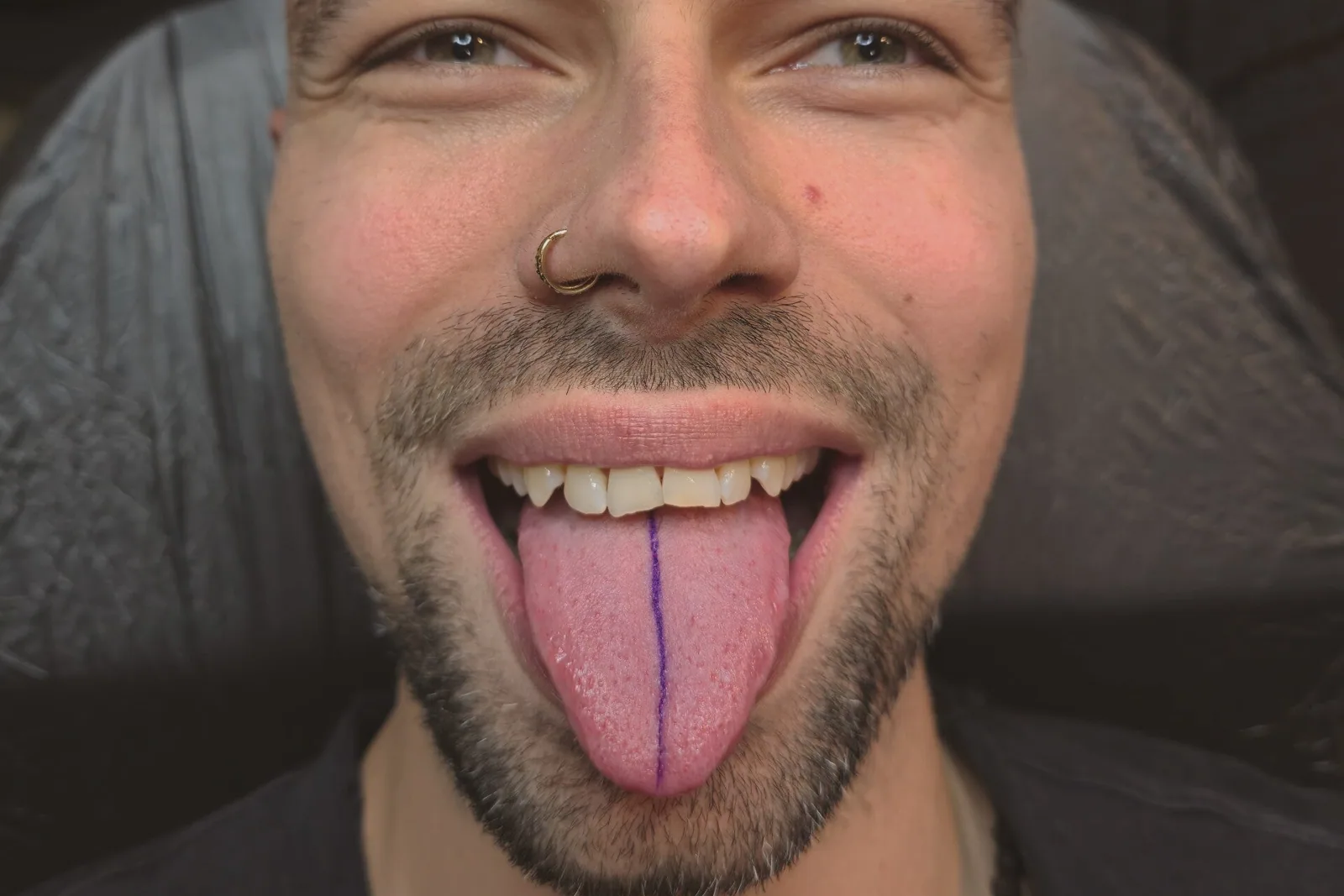 Zungenspaltung / Tonguesplitting – Beispiel 1
