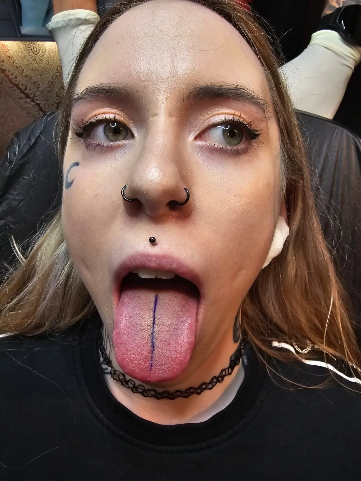 Zungenspaltung / Tonguesplitting – Beispiel 7